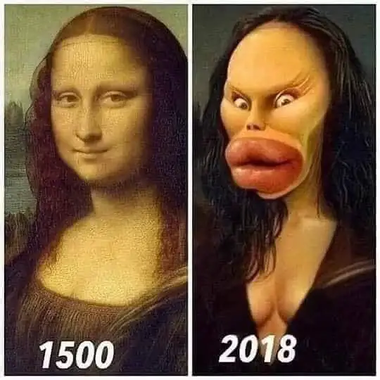 Imagen caricaturesca de la Mona Lisa con intervenciones quirúrgicas.