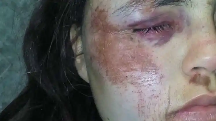 Carhué: Violó la perimetral y con tres hombres atacó a su ex