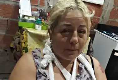 Habló la mujer atacada por el pitbull del ex concejal Marcelo Ríos en Morón: "Nunca me llamó ni para ver como estaba"