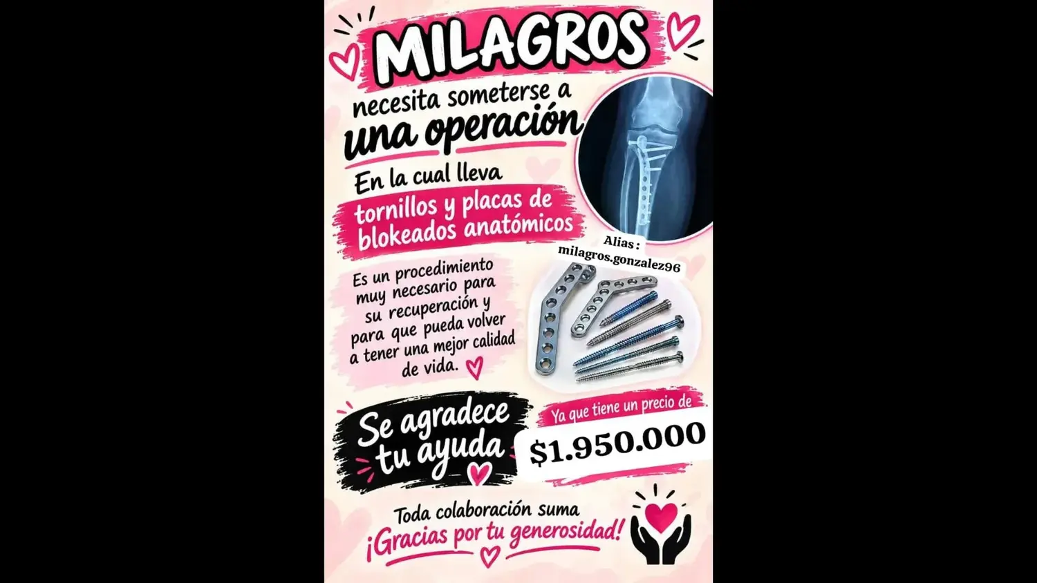 Milagros necesita operarse