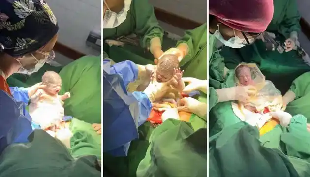 Un caso que sucede cada un millón: nacieron trigemelas en Salta
