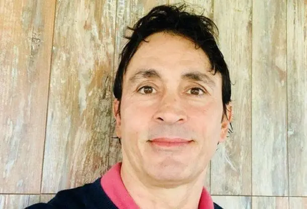 Sebastián Estevanez mostró las fotos de su cara recién quemada por fuego