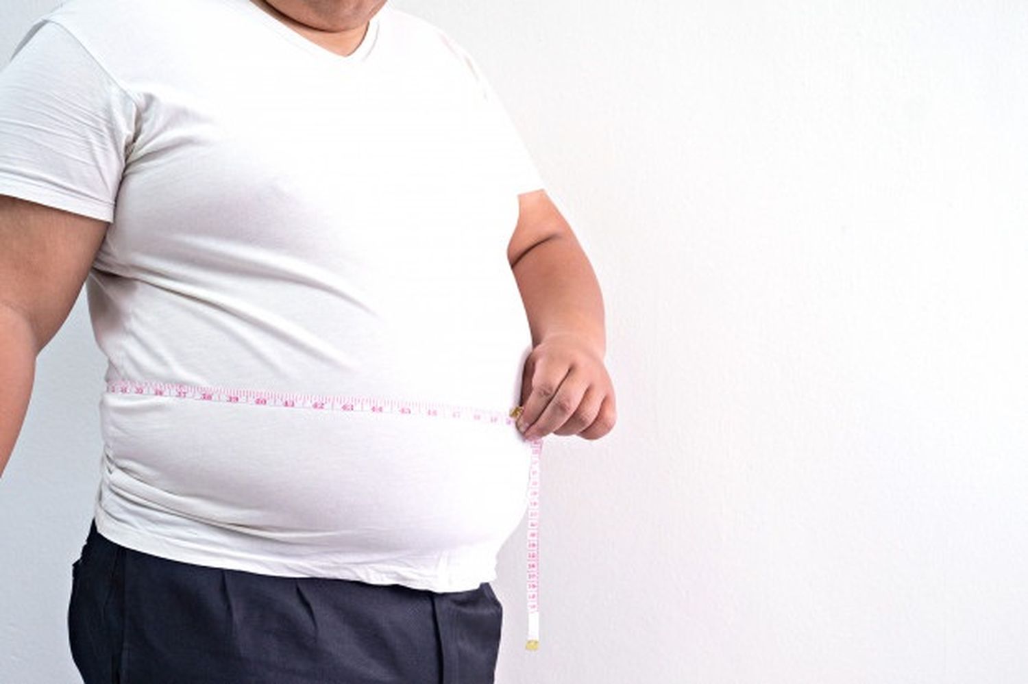 Obesidad: una histórica pandemia
