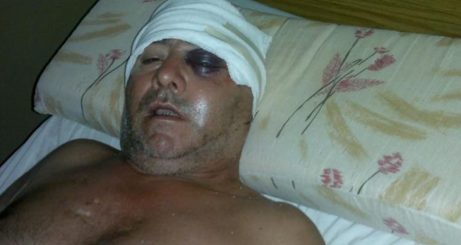 Hombre fue brutalmente golpeado por la expareja de su hija