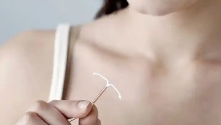 El DIU forma parte de la cartera de anticoncepción que ofrece el Programa de Salud Sexual Integral municipal