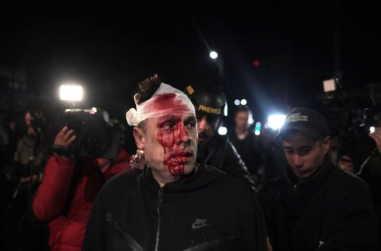 El periodista Cristian Mercatante, herido de un botellazo en el acto de Moreno de LLA (Foto: La Nación)