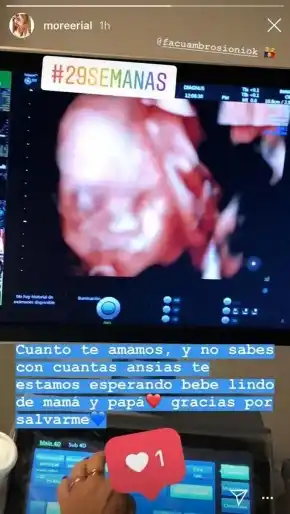 More Rial compartió la eco de su bebé junto a un fuerte mensaje
