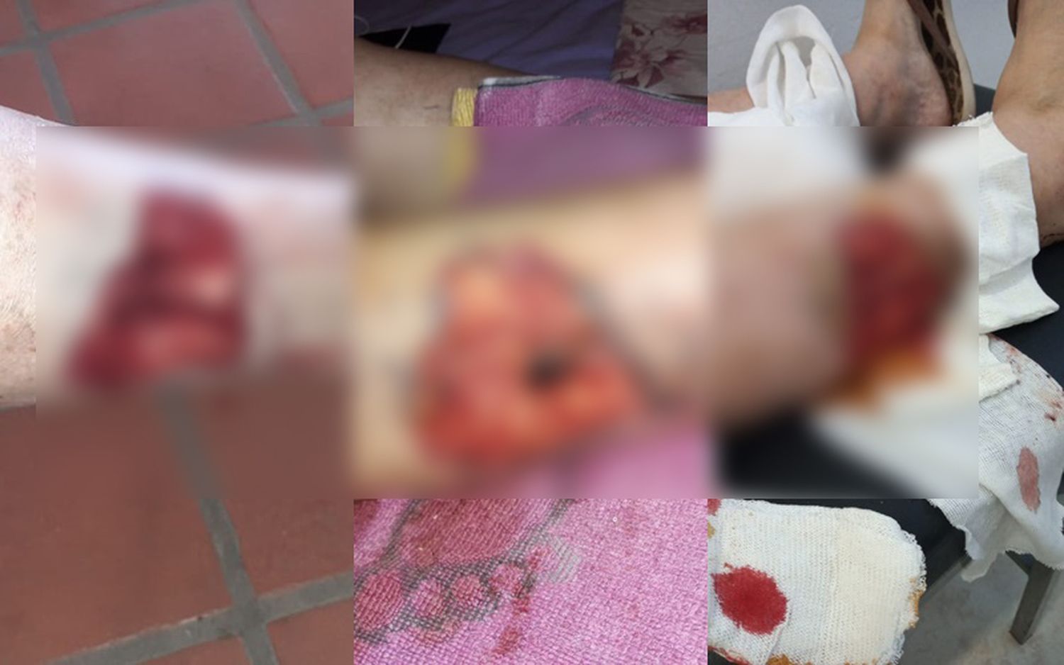 Perro mordió a una mujer y le arrancó un pedazo de una pierna