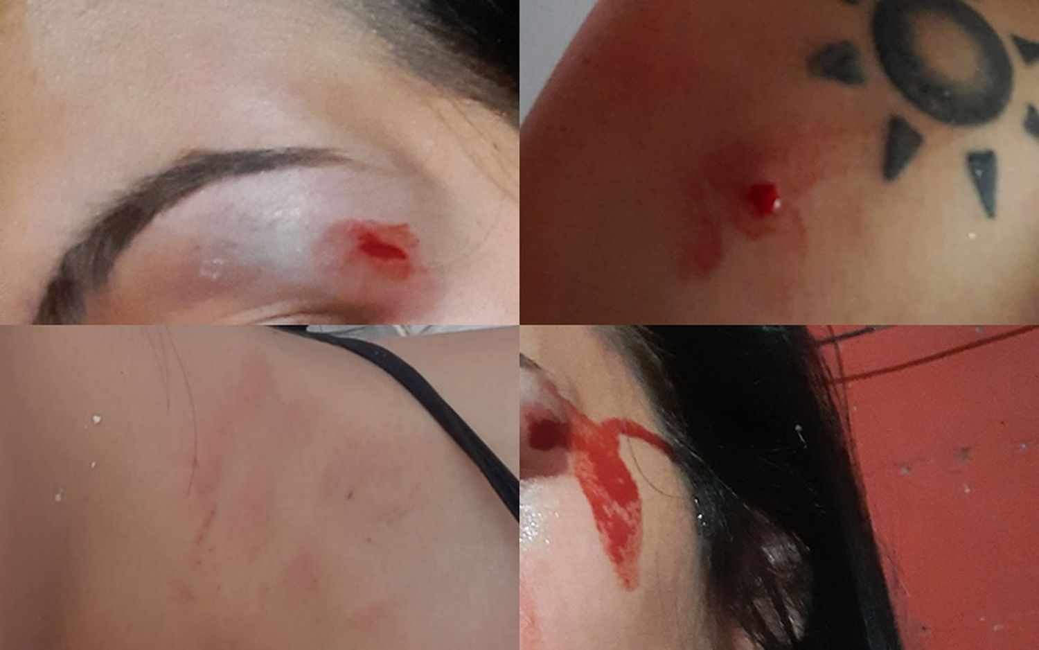 Joven denunció a su expareja por abuso sexual, golpes y amenazas y le impusieron una restricción perimetral