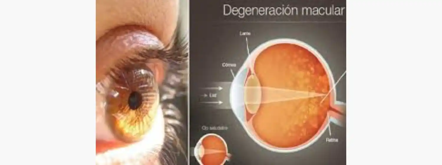 Innovador tratamiento para la degeneración macular seca