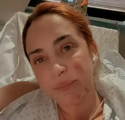 La impactante foto de María Julia Oliván después del accidente que sufrió: “Mi mano es lo más sano que tengo”