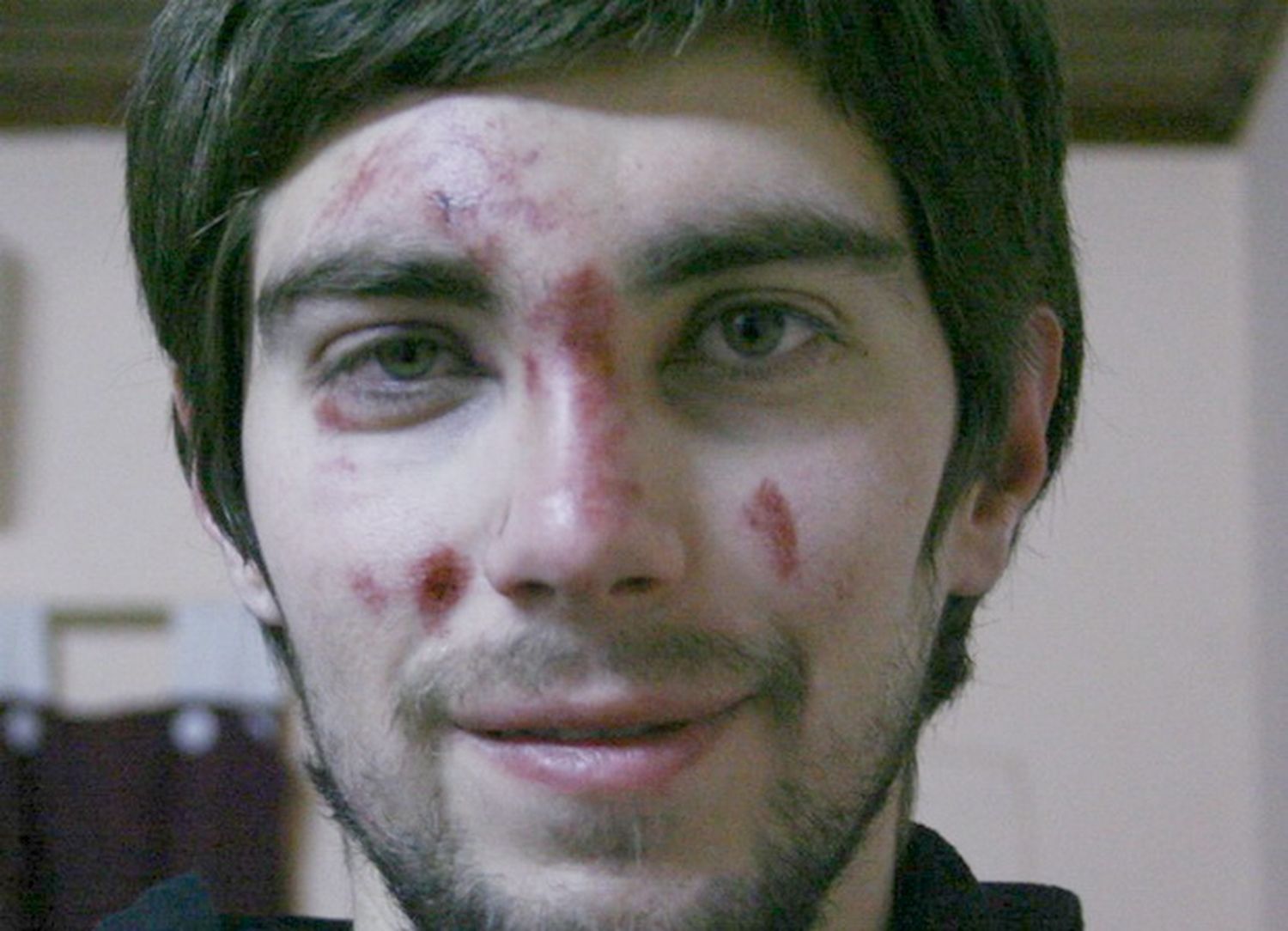 Un joven fue víctima de una brutal golpiza para sacarle 300 pesos