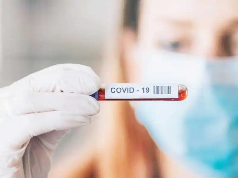Leve descenso de los casos de coronavirus en el cierre de la semana
