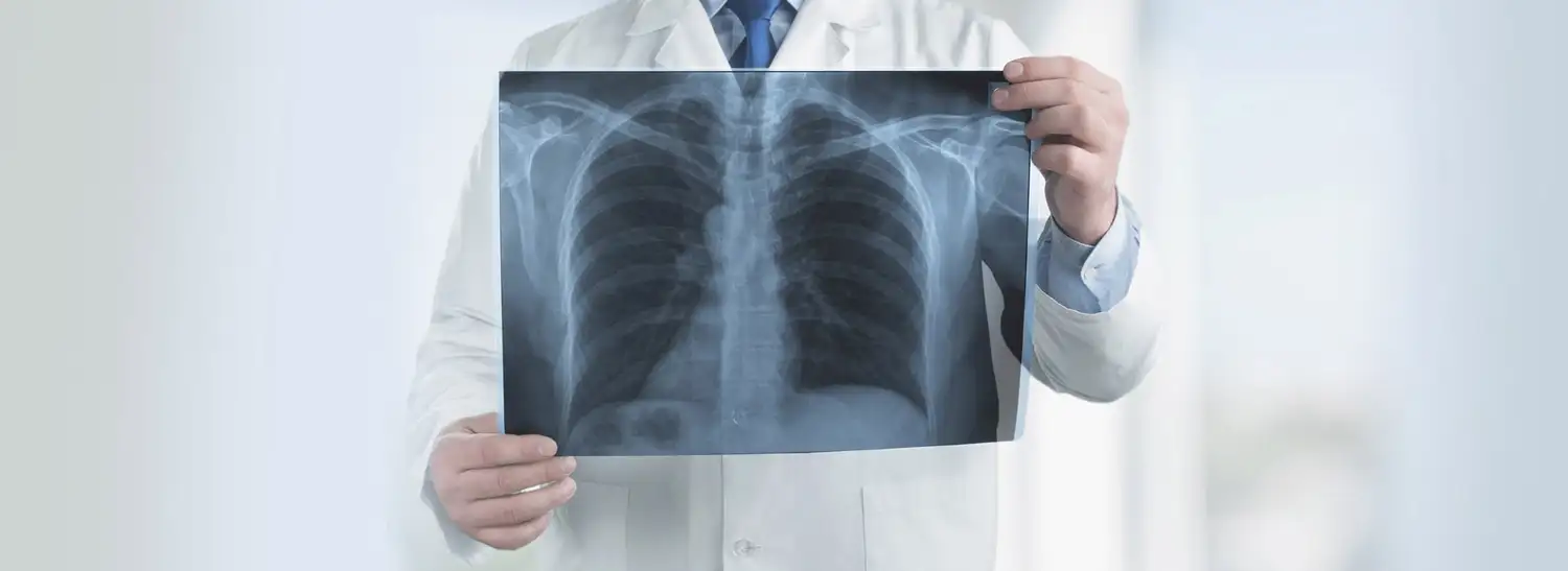 Fibrosis Pulmonar Idiopática, el gran desafío del diagnóstico temprano