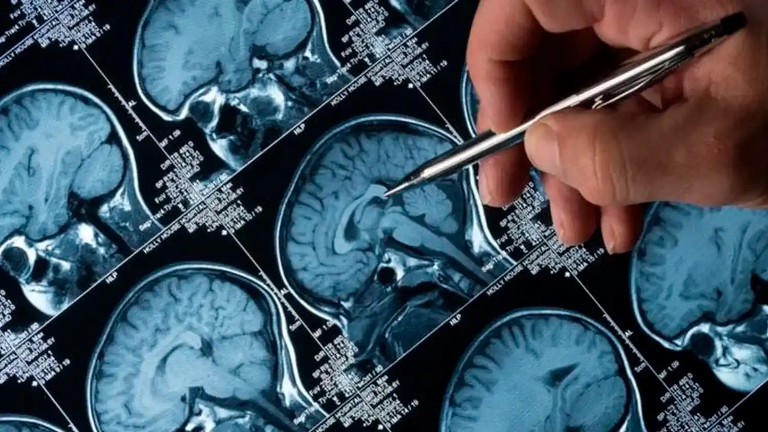 Día Mundial del Neurocirujano: la precisión al servicio de la vida y el legado de un pionero