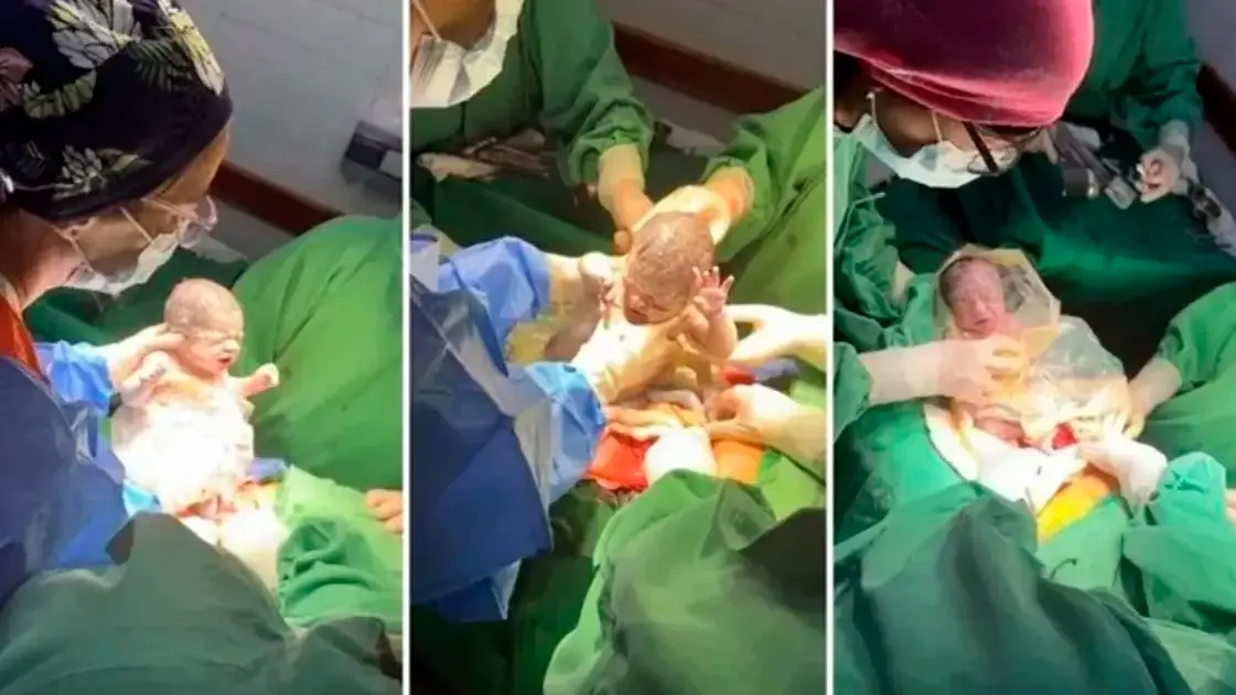Un caso que sucede cada un millón: nacieron trigemelas en Salta