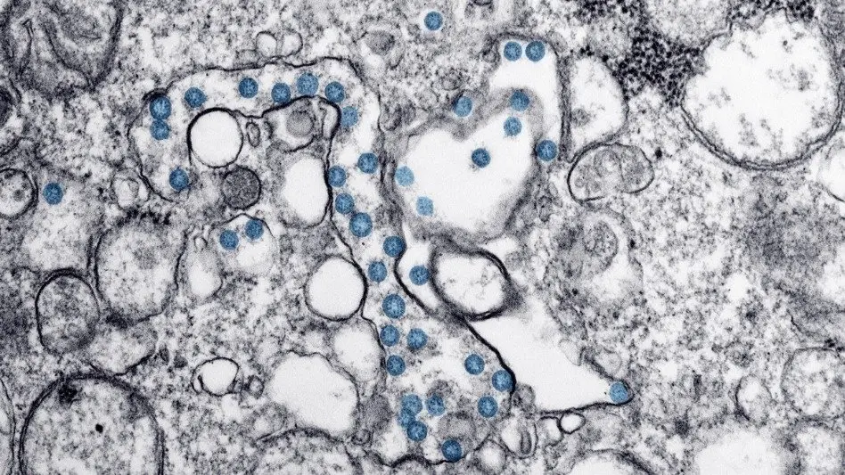 Científicos marplatenses descubrieron un nanomaterial que elimina el virus del COVID de superficies
