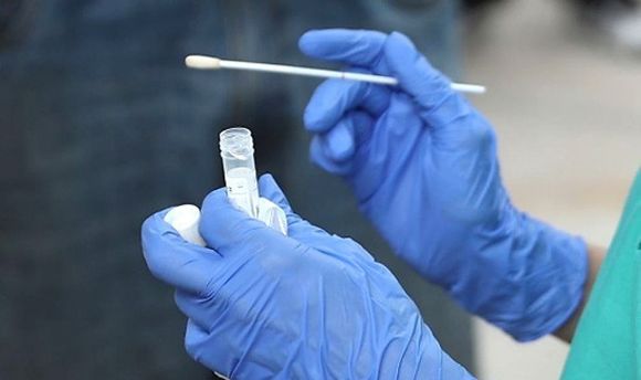 Coronavirus: dos nuevos fallecidos y 28 casos positivos