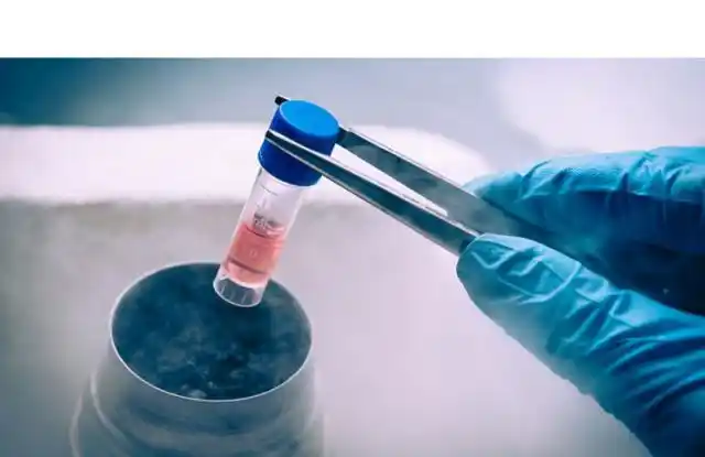 Gracias a un trasplante de células madre eliminaron el VIH en seis pacientes