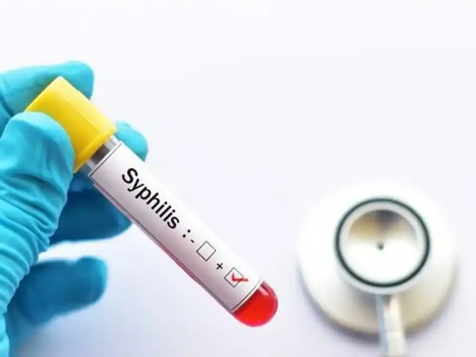 Varias zonas de Argentina manifiestan un alarmante aumento en los casos de sífilis