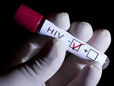Más de 100 nuevos diagnósticos de HIV