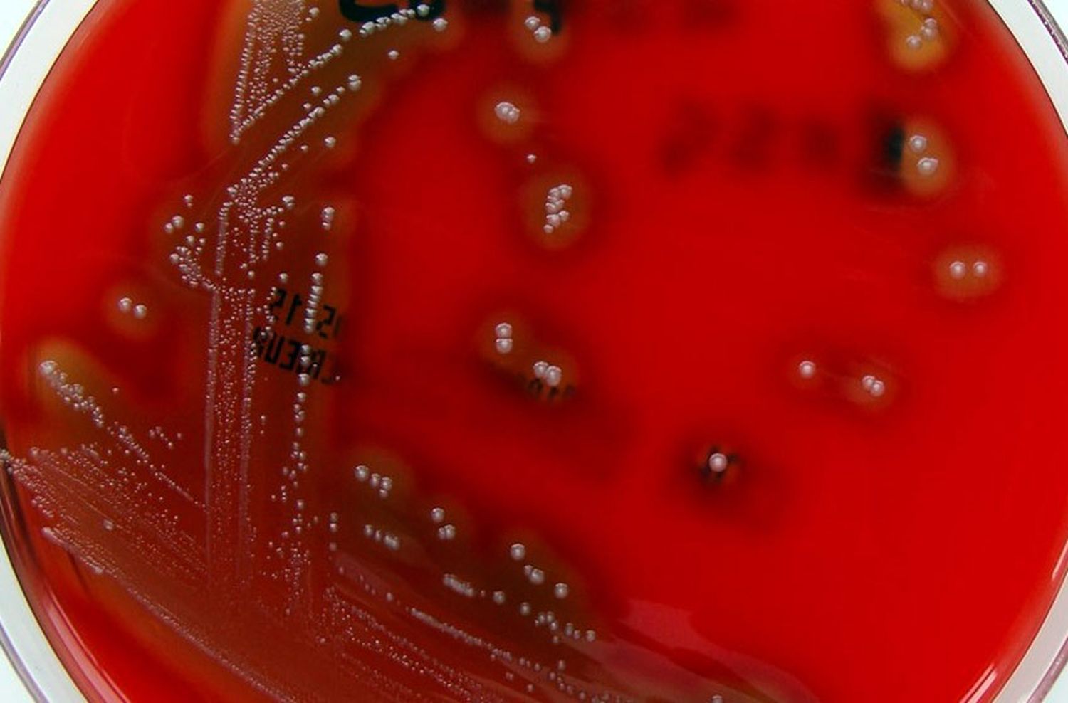 Afirman que aumentó el número de casos de streptococcus pyogenes