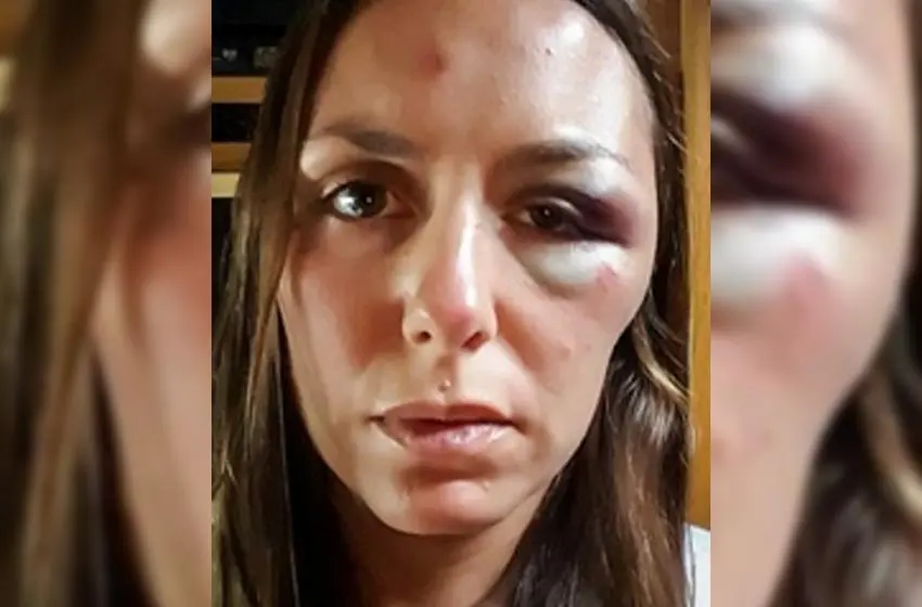 Atacan brutalmente a una rosarina en Ecuador
