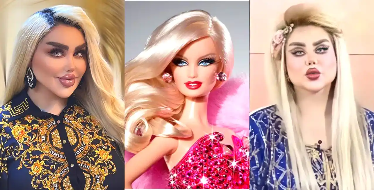 Los usuarios se burlaron de ella y se mostraron preocupados por su adicción a las cirugías.