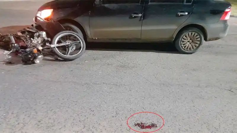 Un motociclista sufrió lesiones graves al impactar de frente contra un auto