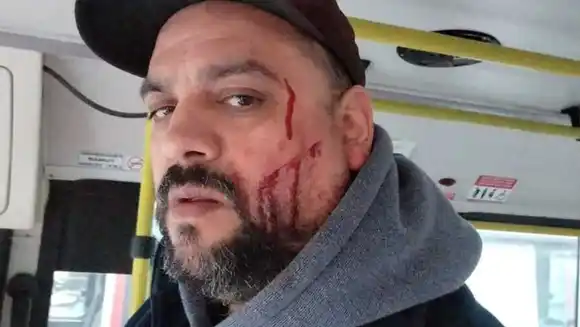 Le cortaron la cara con un cúter a un chofer en Moreno por no dejarlos viajar con un certificado de discapacidad trucho