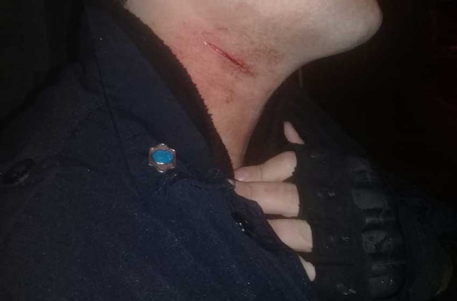 Delincuentes le cortaron el cuello a un Policía Local