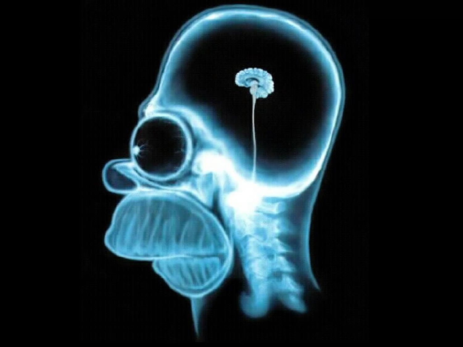 ¡Es el cerebro, imbécil!
