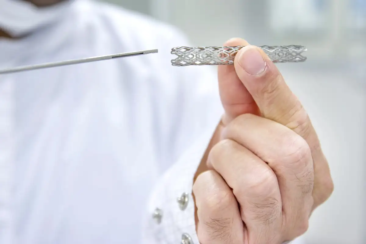 Debido a los costos de los materiales, existen demoras en la colocación de stents a nivel local