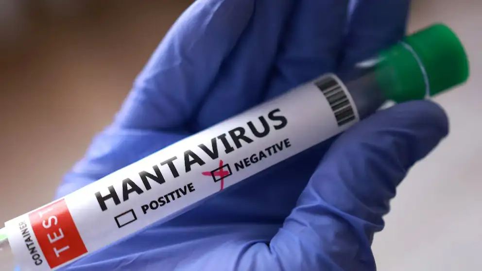 Hantavirus - 1