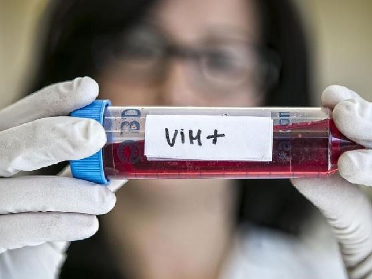 En el país crecen los casos de VIH Sida: en San Francisco es más alarmante