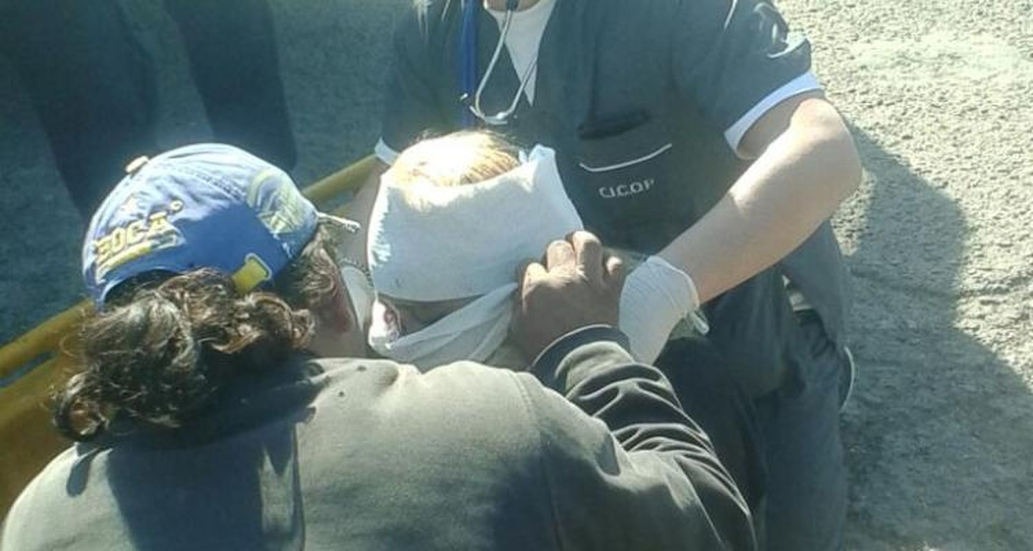 Accidente camino a la Escuela 13: Motociclista sufrió fractura de nariz