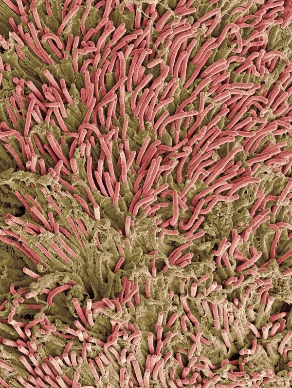 La ciencia, cerca de responder una pregunta clave sobre el cáncer