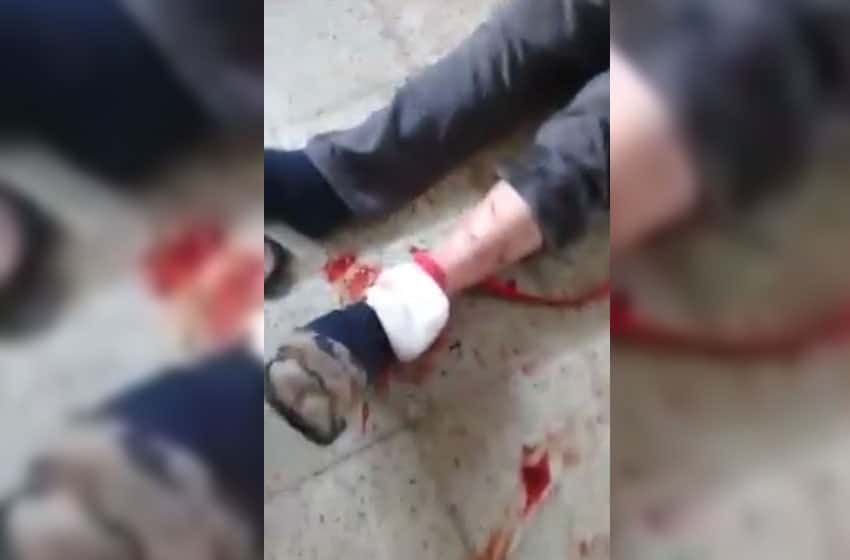 Preocupación en Félix U. Camet por dos perros que atacan a vecinos