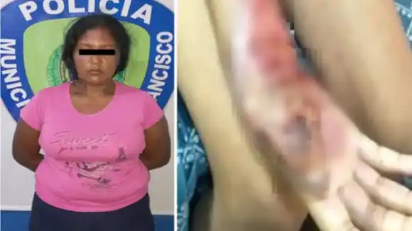 ¡CASTIGO CRUEL! Madre reprende a su hija de 6 años quemándole las manos con la cocina