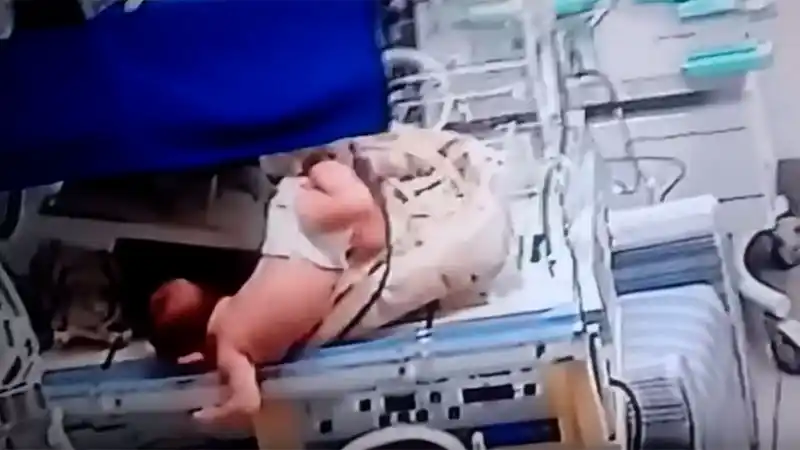 Video: una beba se cayó de una incubadora y sufrió fractura de cráneo  