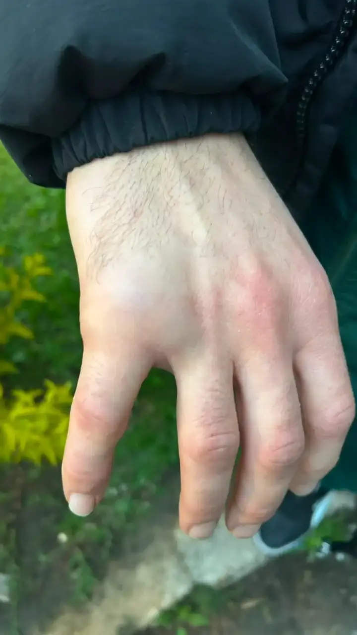 Mano de Martina