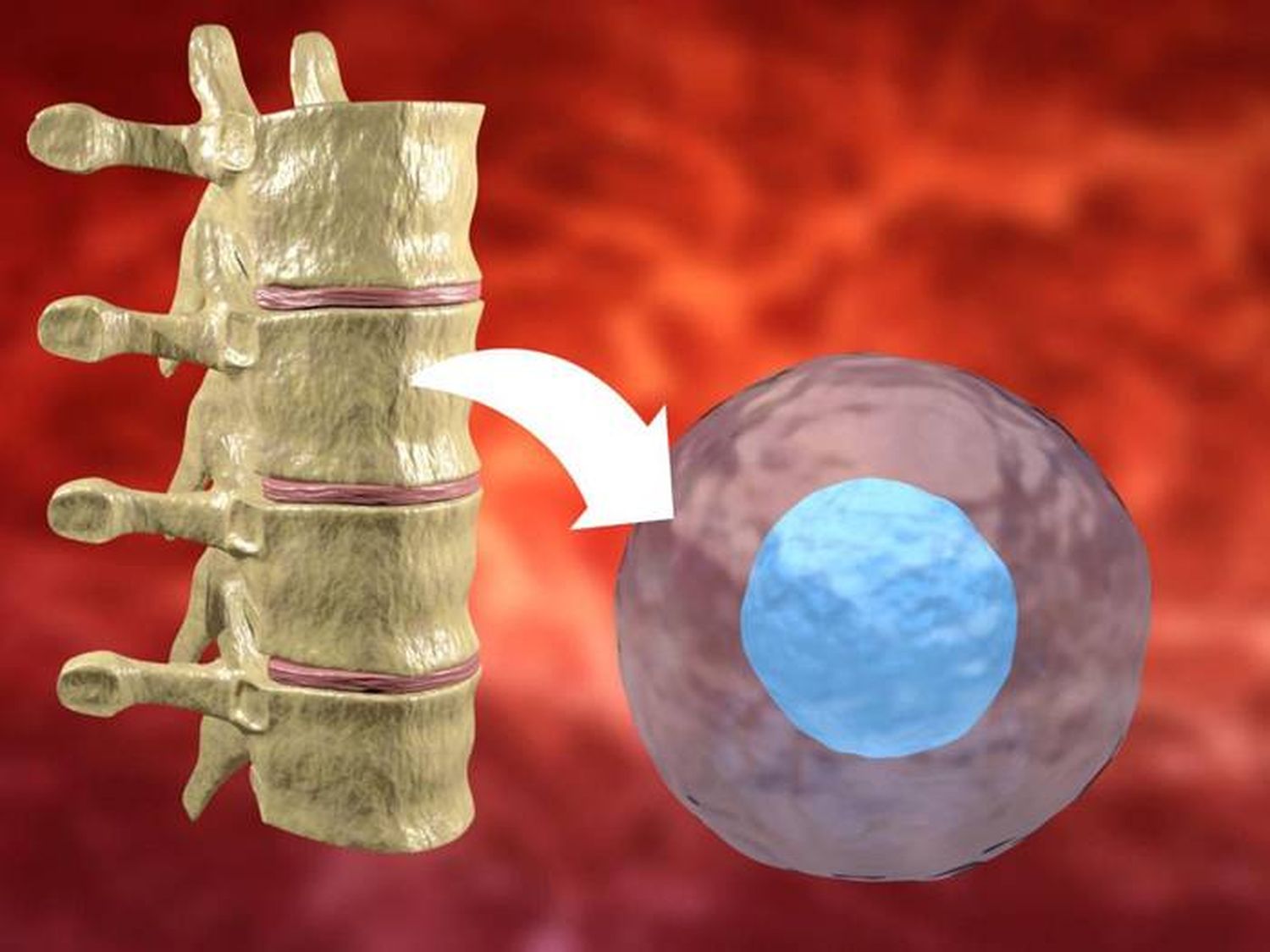 ¿Por qué es importante donar médula ósea?