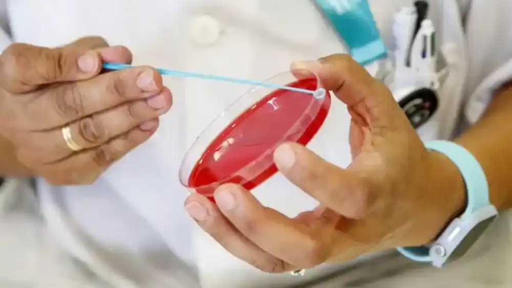 46.799 casos de sífilis se notificaron en el país en 2025,