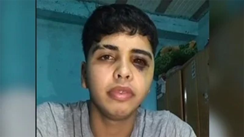 Una joven discutió con su novio y lo golpeó con un palo de amasar en la cara