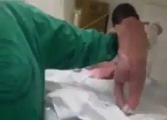 Imperdible: El bebé que empieza a caminar en la sala de partos