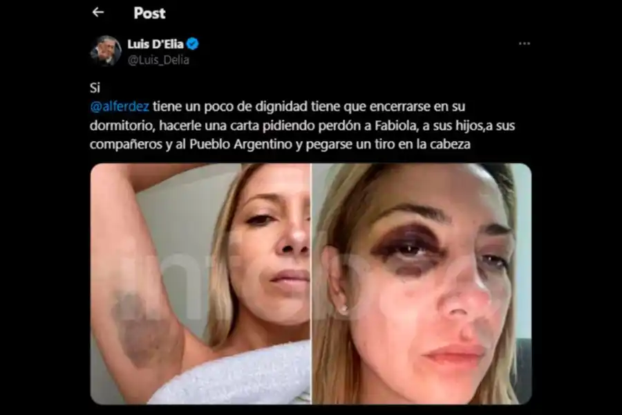 El mensaje de D'elía en X