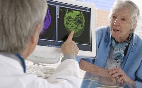 La inmunoterapia llega al Alzhéimer