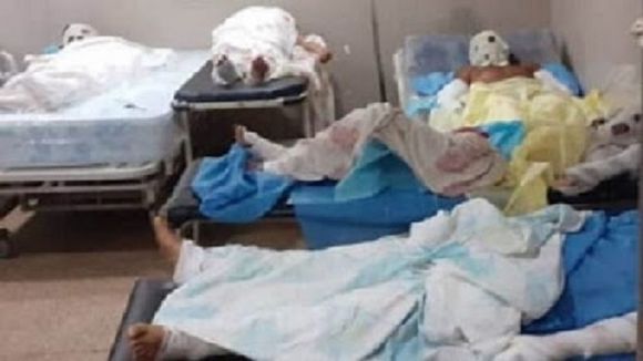 DEJARON DE FUNCIONAR los aires acondicionados donde se encuentran quemados de la explosión  en Monagas