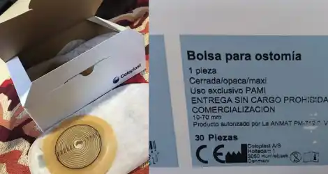 Solidaridad: Regalo bolsitas de ostomía