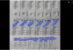 "Es muy triste y angustiante para nosotras dar tantos resultados positivos"